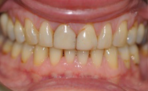 Before - Bassett Dental & Aesthetics