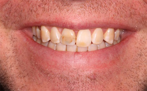 Before - Bassett Dental & Aesthetics