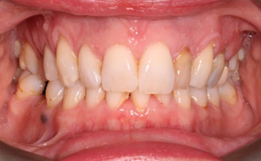 Before - Bassett Dental & Aesthetics