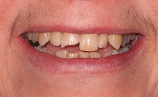 BassettDental - Before