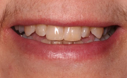 BassettDental - After