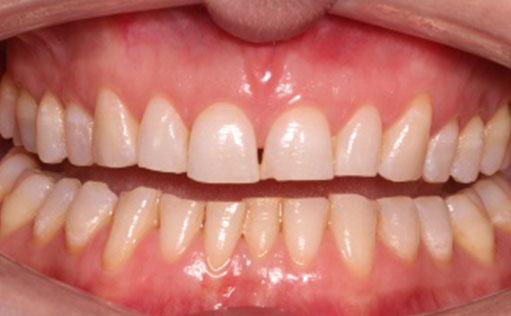 Before - Bassett Dental & Aesthetics