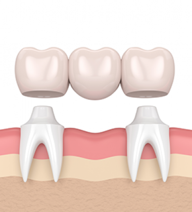 BassettDental - treatment