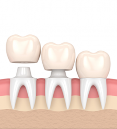 BassettDental - treatment