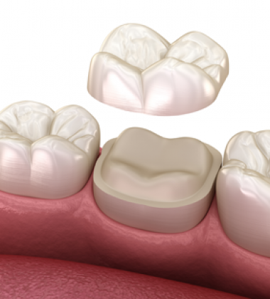 BassettDental - treatment