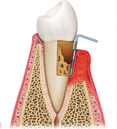 BassettDental - treatment